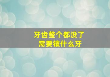 牙齿整个都没了 需要镶什么牙